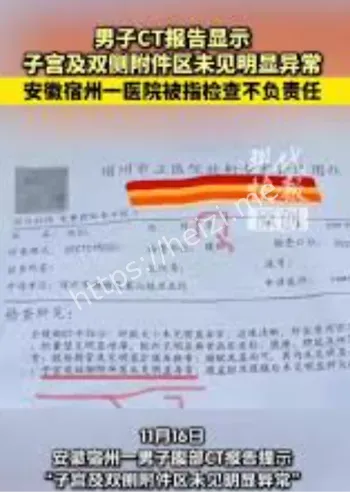 安徽宿州CT子宫报告